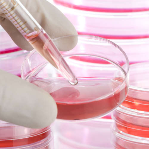 Custom Cell Line Development Services