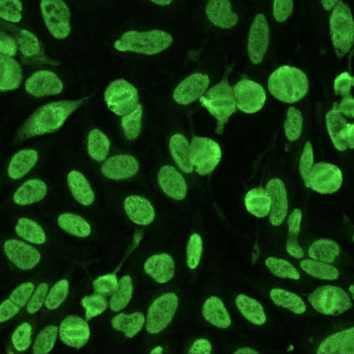 Custom Cell Line Development Services