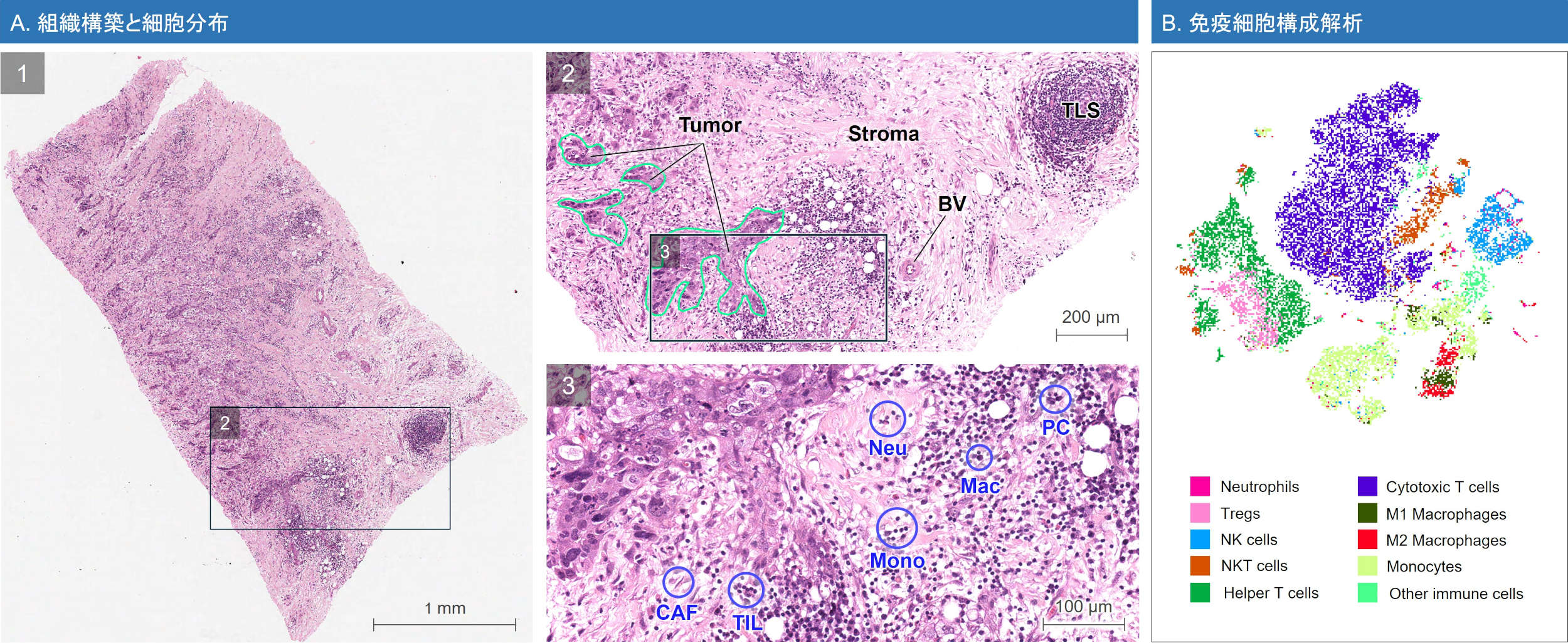 TruTumor Tissue Composition